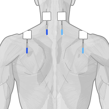 Globus | Genesy 3000, Electroestimulador De 4 Canales Con 423 Programas, De Uso Profesional Y De Rehabilitación Para El Tratamiento De Las Patologías Del Sistema Musculoesquelético